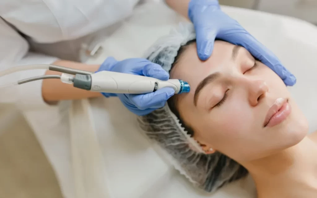 Ein Behandler verwendet ein Microneedling-Gerät auf der Stirn einer Frau während einer Mesotherapie-Behandlung, um die Hautfeuchtigkeit und Verjüngung zu verbessern.